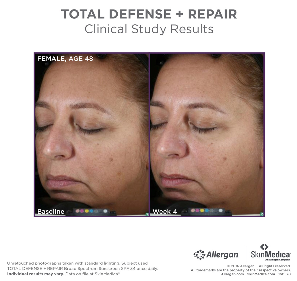 total defense+repair clinical study results