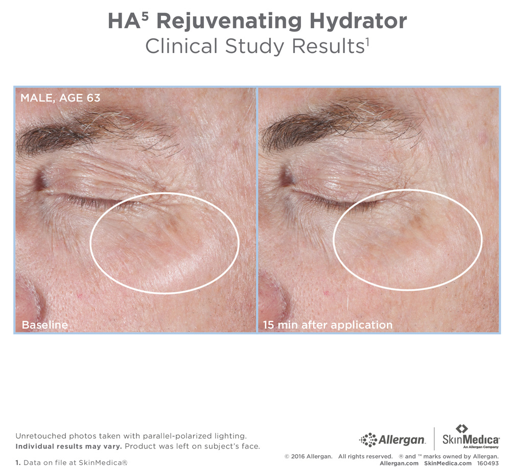ha5 rejuvenating hydrator clinical study results