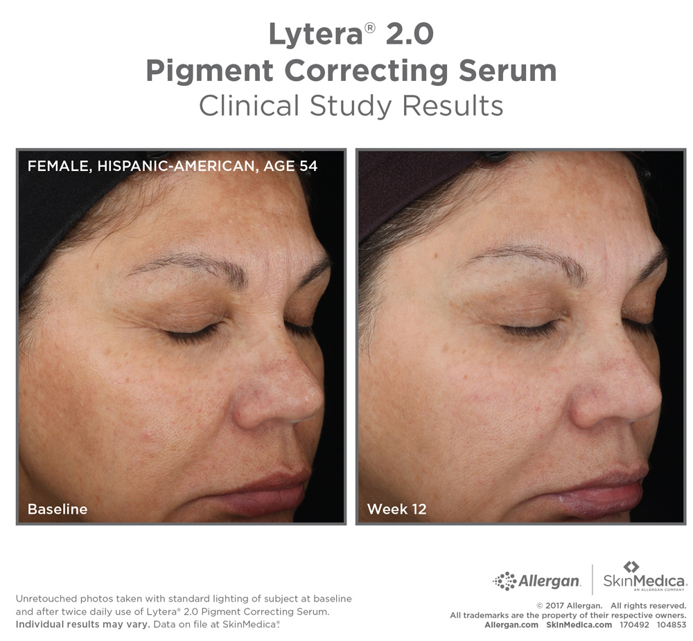 lytera 20 pigment correcting serum clinical study results