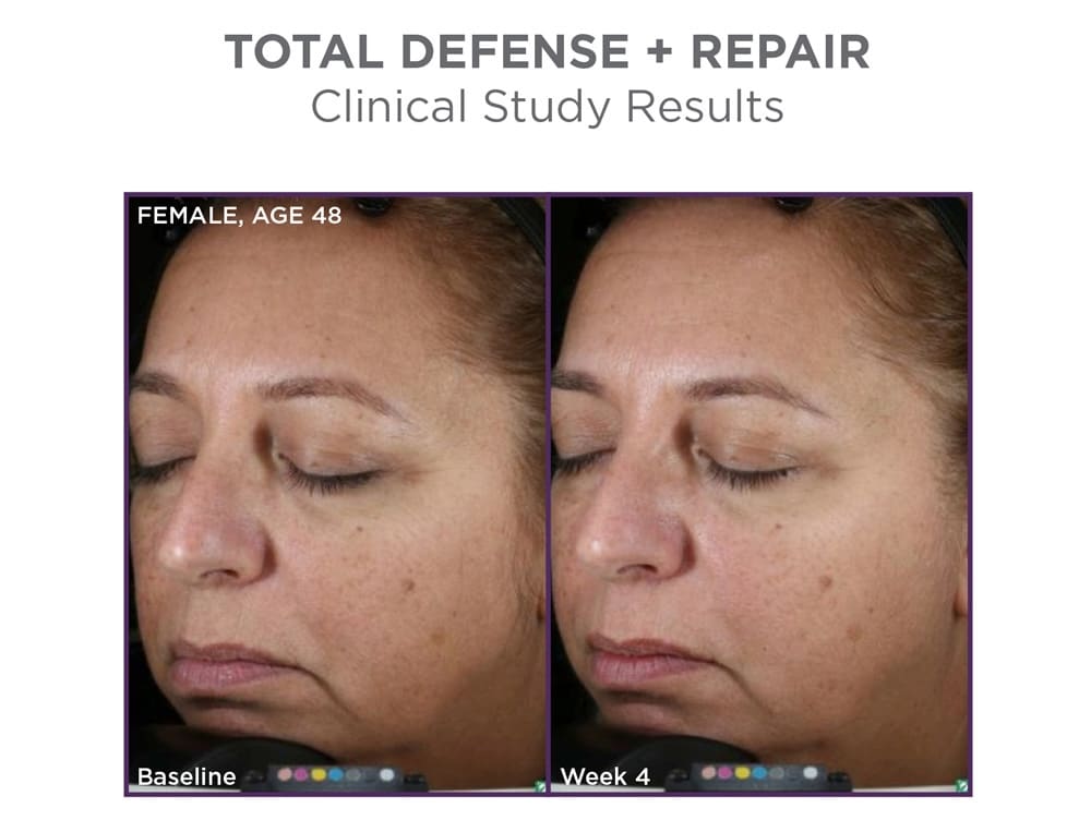 beforeafter