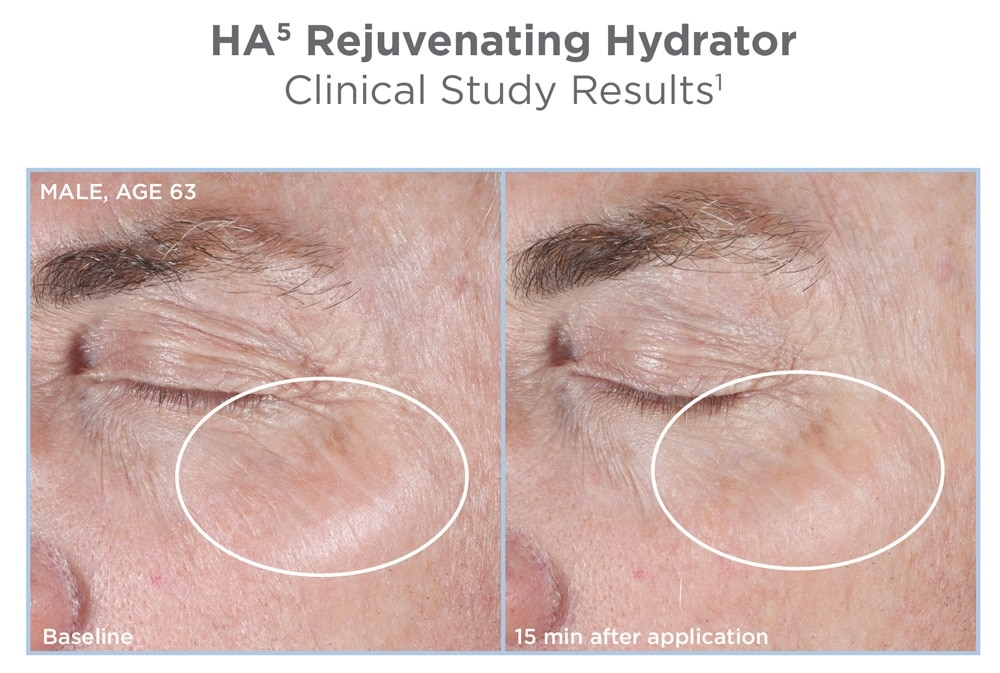 habeforeafter