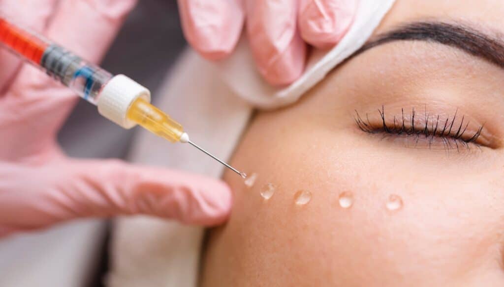 woman receiving voluma lip injection